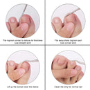 Cortador de unhas do dedo do pé para unhas encravadas ou grossas aparador de unhas profissional