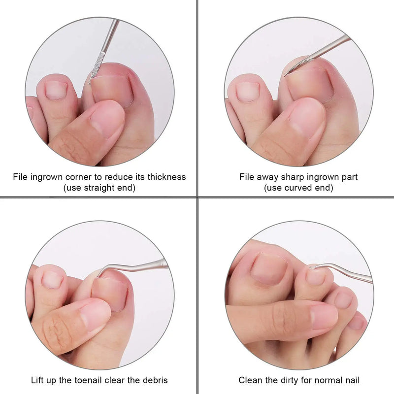 Cortador de unhas do dedo do pé para unhas encravadas ou grossas aparador de unhas profissional